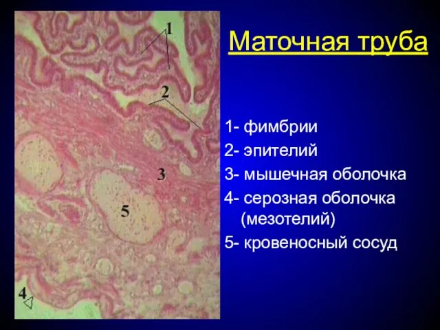 Маточная труба 1- фимбрии 2- эпителий 3- мышечная оболочка 4- серозная оболочка (мезотелий) 5- кровеносный сосуд