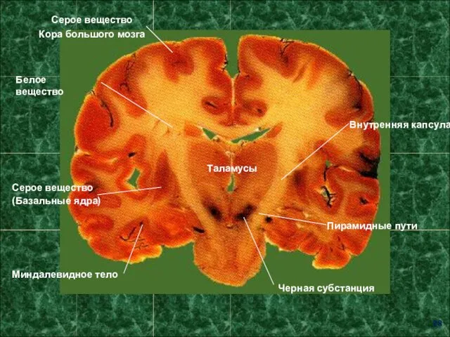 Белое вещество Серое вещество Кора большого мозга Внутренняя капсула Таламусы