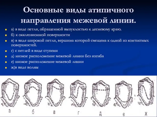 Основные виды атипичного направления межевой линии. а) в виде петли,