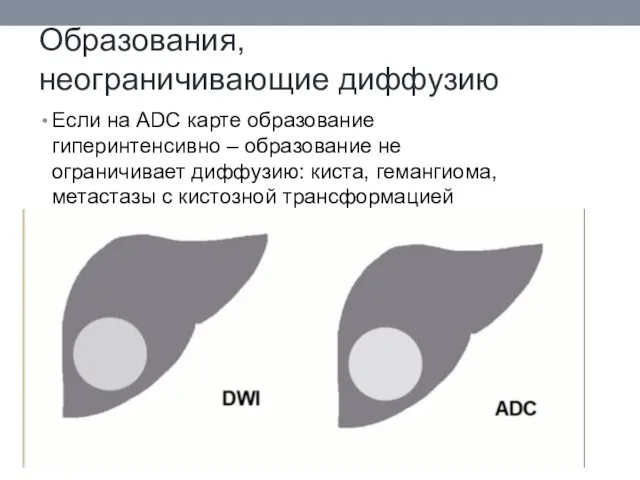 Образования, неограничивающие диффузию Если на ADC карте образование гиперинтенсивно –