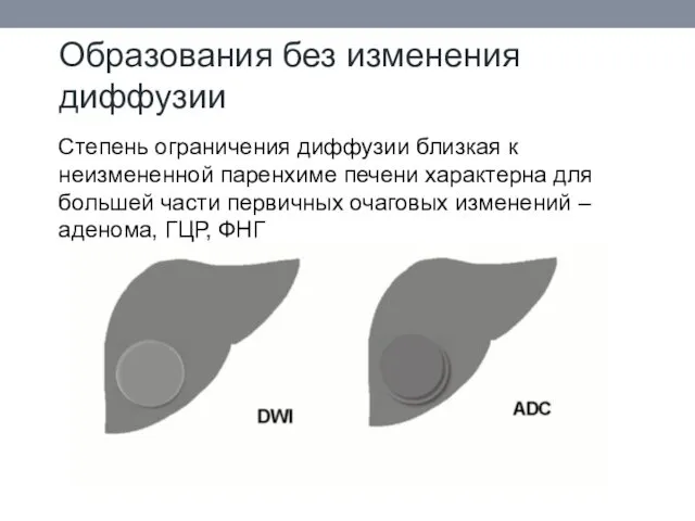 Образования без изменения диффузии Степень ограничения диффузии близкая к неизмененной