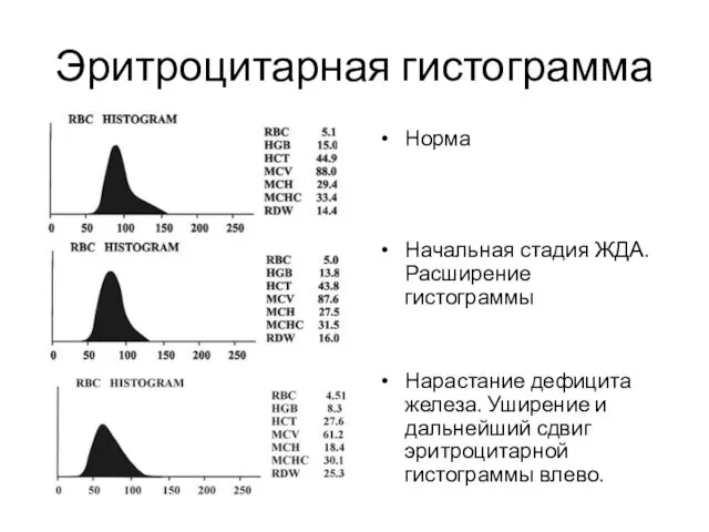 Эритроцитарная гистограмма Норма Начальная стадия ЖДА. Расширение гистограммы Нарастание дефицита