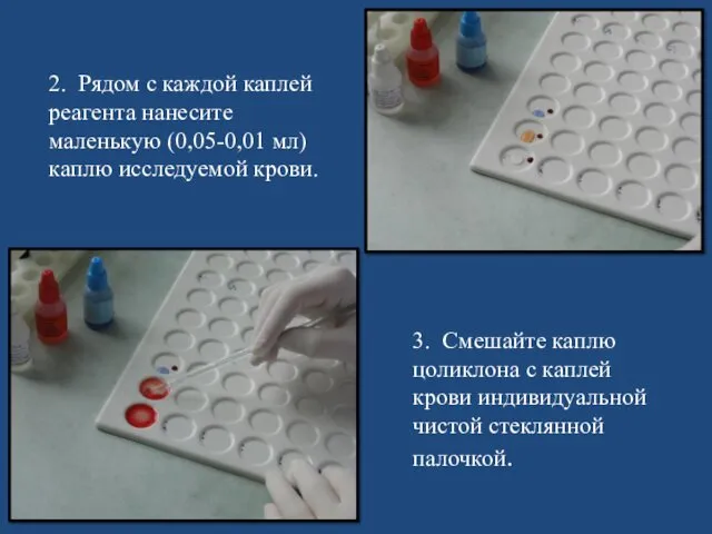 3. Смешайте каплю цоликлона с каплей крови индивидуальной чистой стеклянной палочкой. 2. Рядом