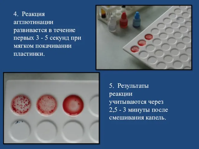 4. Реакция агглютинации развивается в течение первых 3-5 секунд при мягком покачивании пластинки.