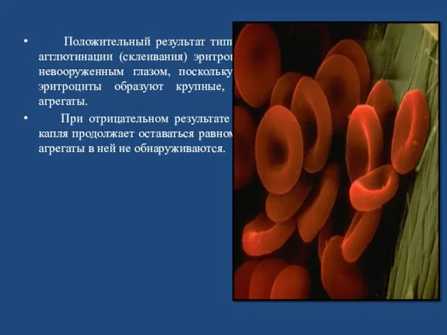 Положительный результат типирования выражается в появлении агглютинации (склеивания) эритроцитов, которую