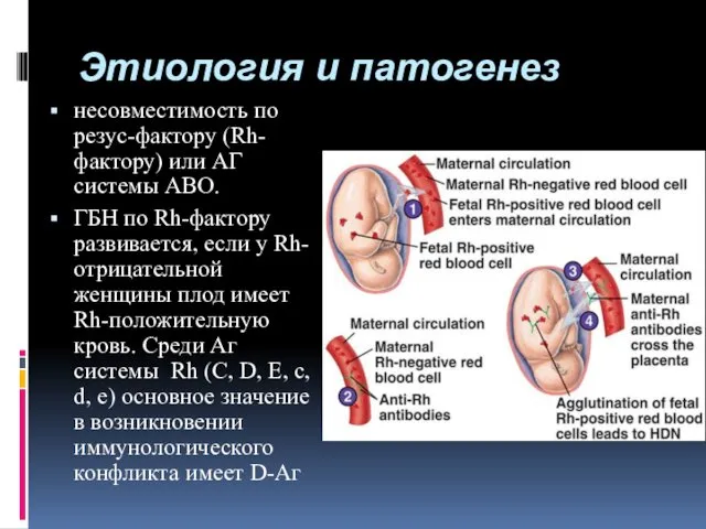 Этиология и патогенез несовместимость по резус-фактору (Rh-фактору) или АГ системы