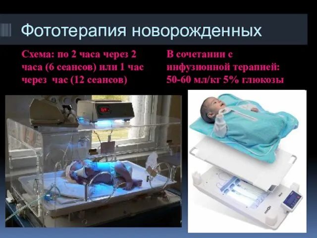 Фототерапия новорожденных Схема: по 2 часа через 2 часа (6