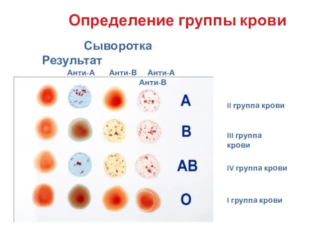 II группа крови III группа крови IV группа крови I