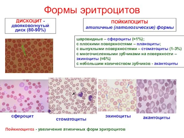 Формы эритроцитов ДИСКОЦИТ - двояковогнутый диск (80-90%) ПОЙКИЛОЦИТЫ атипичные (патологические)