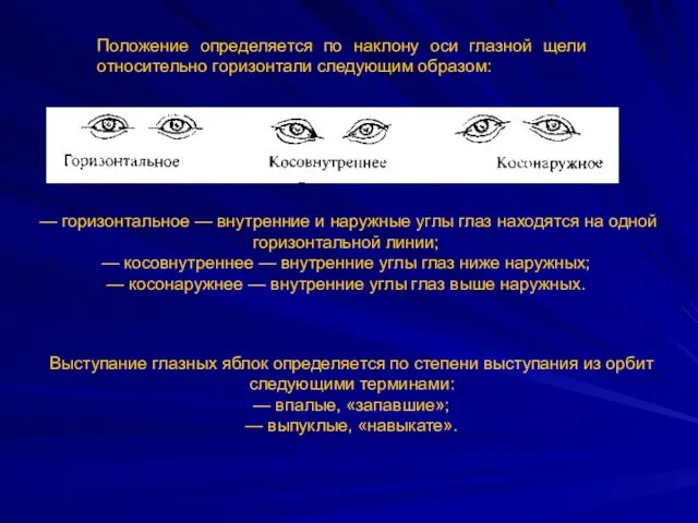 Положение определяется по наклону оси глазной щели относительно горизонтали следующим