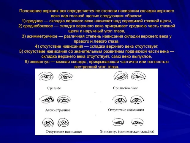 Положение верхних век определяется по степени нависания складки верхнего века