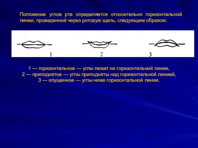 Положение углов рта определяется относительно горизонтальной линии, проведенной через ротовую