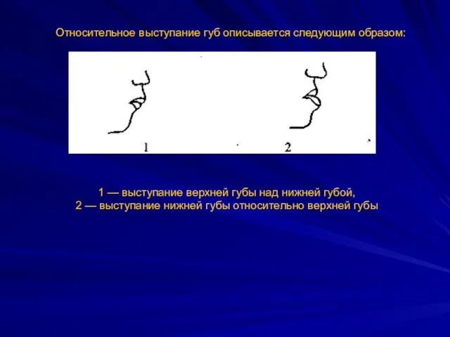 Относительное выступание губ описывается следующим образом: 1 — выступание верхней