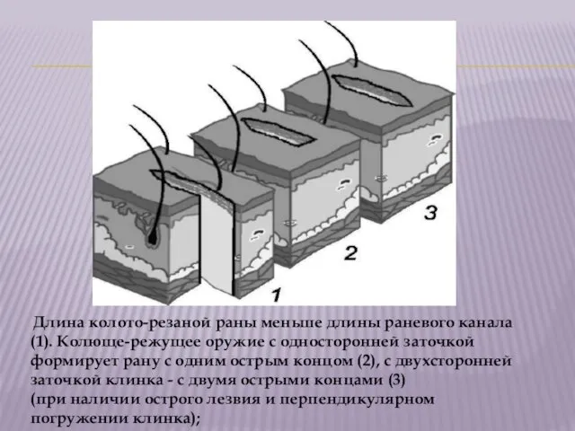 Длина колото-резаной раны меньше длины раневого канала (1). Колюще-режущее оружие