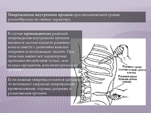 Повреждения внутренних органов при механической травме разнообразны по своему характеру.