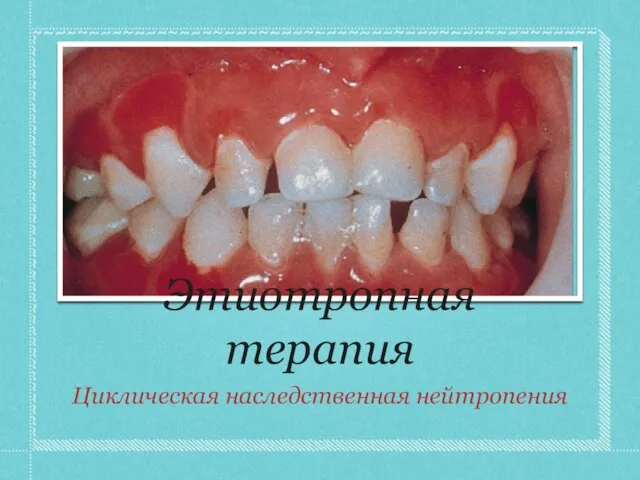 Этиотропная терапия Циклическая наследственная нейтропения