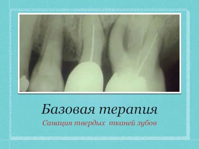 Базовая терапия Санация твердых тканей зубов