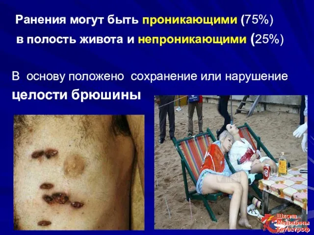 Ранения могут быть проникающими (75%) в полость живота и непроникающими