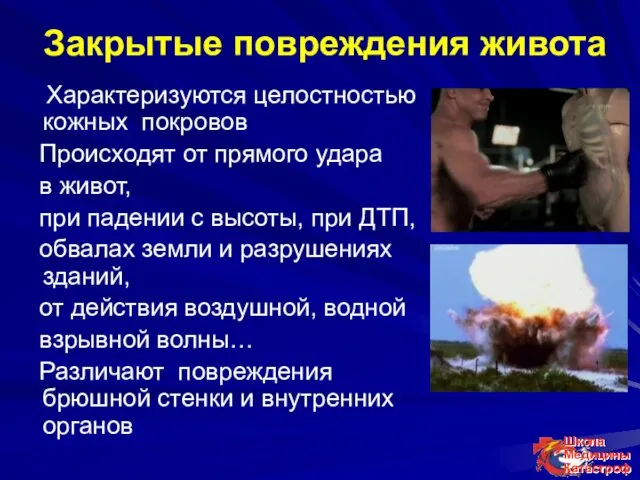 Закрытые повреждения живота Характеризуются целостностью кожных покровов Происходят от прямого