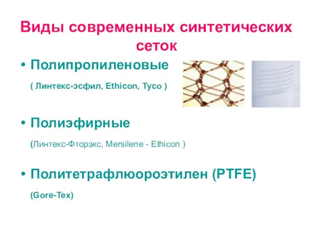 Виды современных синтетических сеток Полипропиленовые ( Линтекс-эсфил, Ethicon, Tyco )