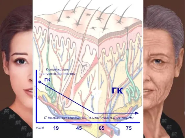Концентрация гиалуроновой кислоты ГК ГК 19 45 65 75 годы