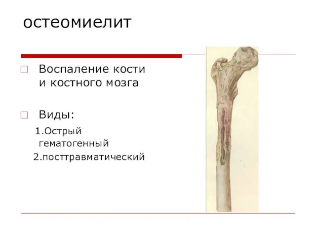 остеомиелит Воспаление кости и костного мозга Виды: 1.Острый гематогенный 2.посттравматический