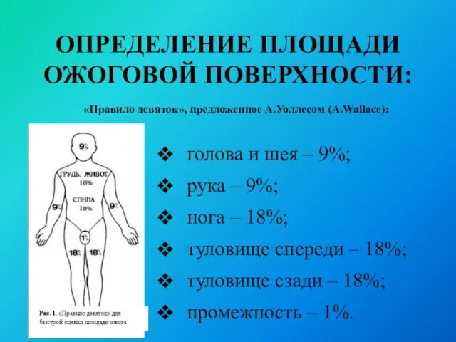 ОПРЕДЕЛЕНИЕ ПЛОЩАДИ ОЖОГОВОЙ ПОВЕРХНОСТИ: «Правило девяток», предложенное А.Уоллесом (А.Wallace): голова