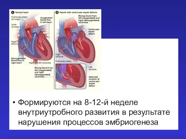 Формируются на 8-12-й неделе внутриутробного развития в результате нарушения процессов эмбриогенеза