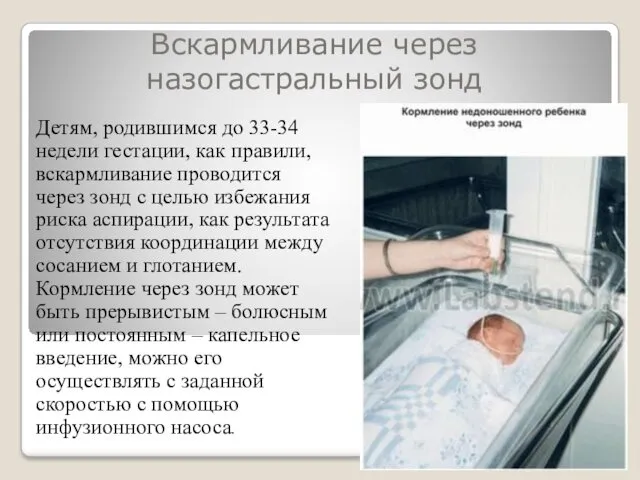 Вскармливание через назогастральный зонд Детям, родившимся до 33-34 недели гестации, как правили, вскармливание