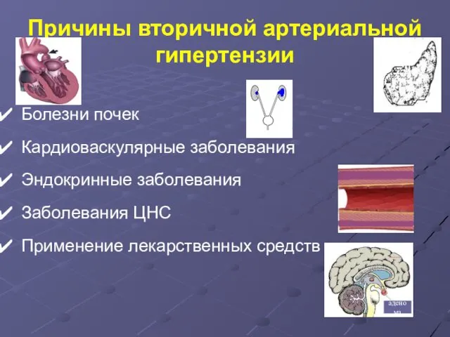 Причины вторичной артериальной гипертензии Болезни почек Кардиоваскулярные заболевания Эндокринные заболевания Заболевания ЦНС Применение лекарственных средств