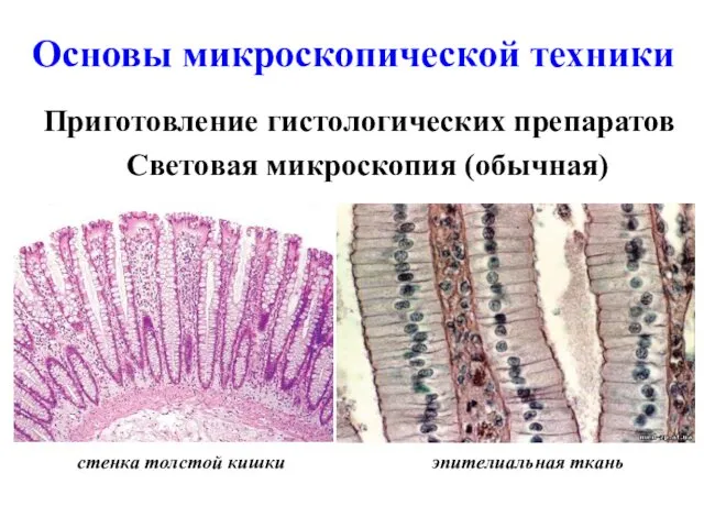 Основы микроскопической техники Приготовление гистологических препаратов Световая микроскопия (обычная) эпителиальная ткань стенка толстой кишки