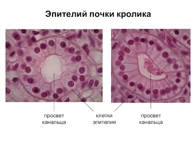 Эпителий почки кролика просвет канальца просвет канальца клетки эпителия