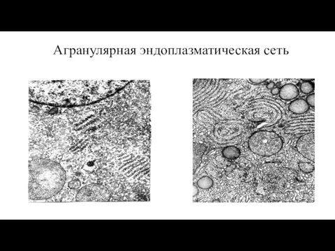 Агранулярная эндоплазматическая сеть