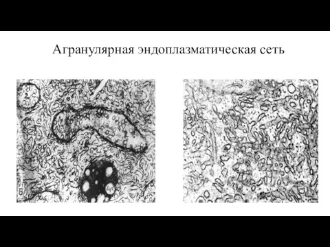 Агранулярная эндоплазматическая сеть