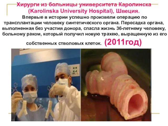 Хирурги из больницы университета Каролинска (Karolinska University Hospital), Швеция. Впервые