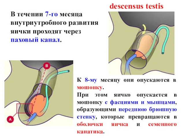 descensus testis В течении 7-го месяца внутриутробного развития яички проходят