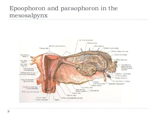 Epoophoron and paraophoron in the mesosalpynx