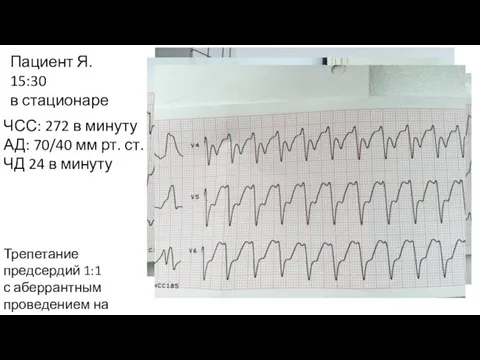 ЧСС: 272 в минуту АД: 70/40 мм рт. ст. ЧД