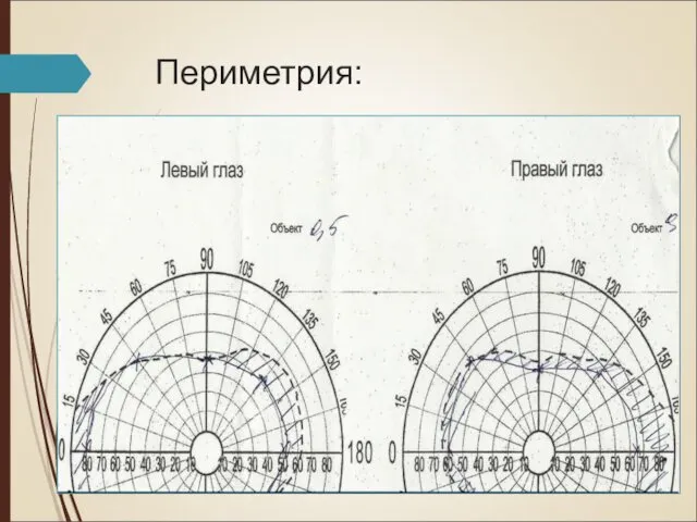 Периметрия: