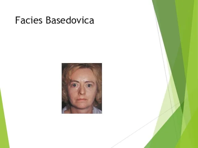 Facies Basedovica