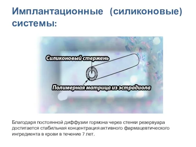 Имплантационные (силиконовые) системы: Благодаря постоянной диффузии гормона через стенки резервуара