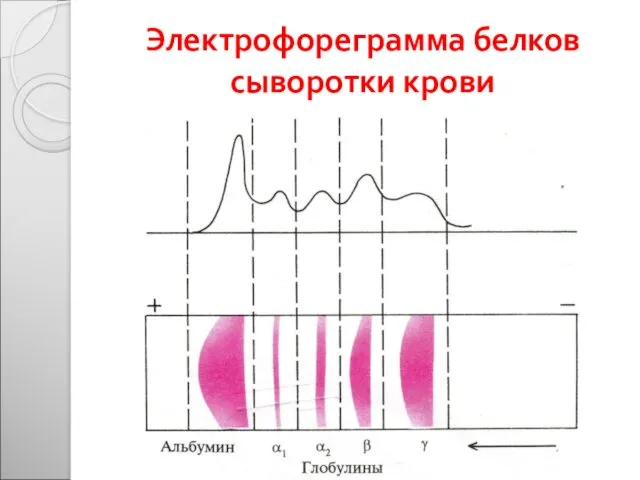 Электрофореграмма белков сыворотки крови