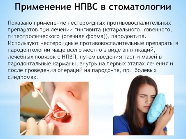 Применение НПВС в стоматологии Показано применение нестероидных противовоспалительных препаратов при лечении гингивита (катарального,