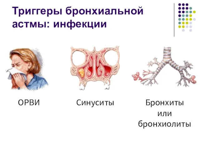 ОРВИ Синуситы Бронхиты или бронхиолиты Триггеры бронхиальной астмы: инфекции