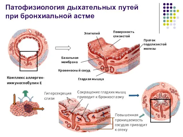 Проток подслизистой железы Поверхность слизистой Эпителий Базальная мембрана Кровеносный сосуд