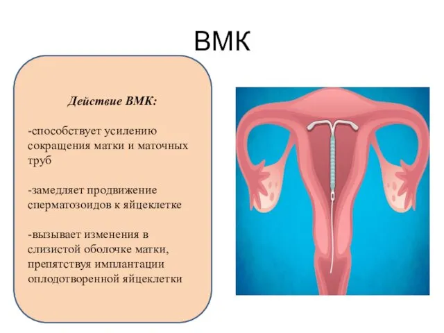 ВМК Действие ВМК: -способствует усилению сокращения матки и маточных труб -замедляет продвижение сперматозоидов