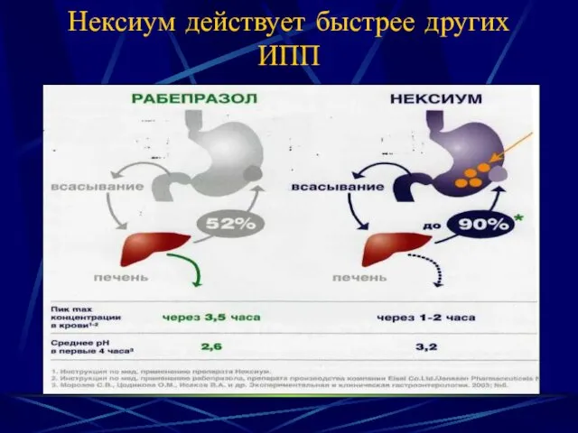 Нексиум действует быстрее других ИПП