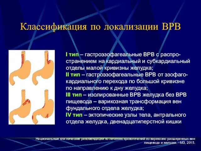 Классификация по локализации ВРВ I тип – гастроэзофагеальные ВРВ с