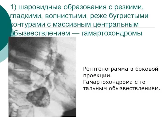 1) шаровидные образования с резкими, гладкими, волнистыми, реже бугристыми контурами