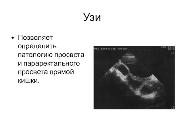 Узи Позволяет определить патологию просвета и параректального просвета прямой кишки.